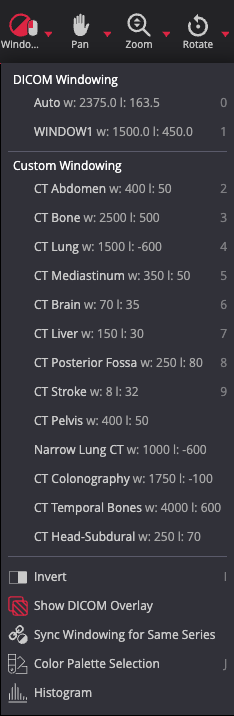 CT windows