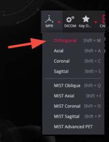 Collective Minds Viewer MPR orthogonal