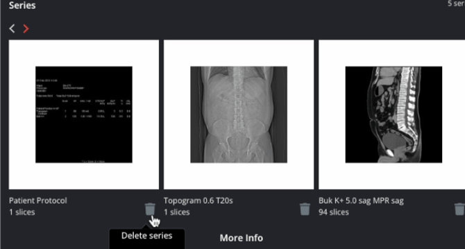 list delete series 2