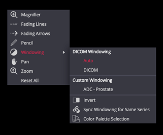 window auto